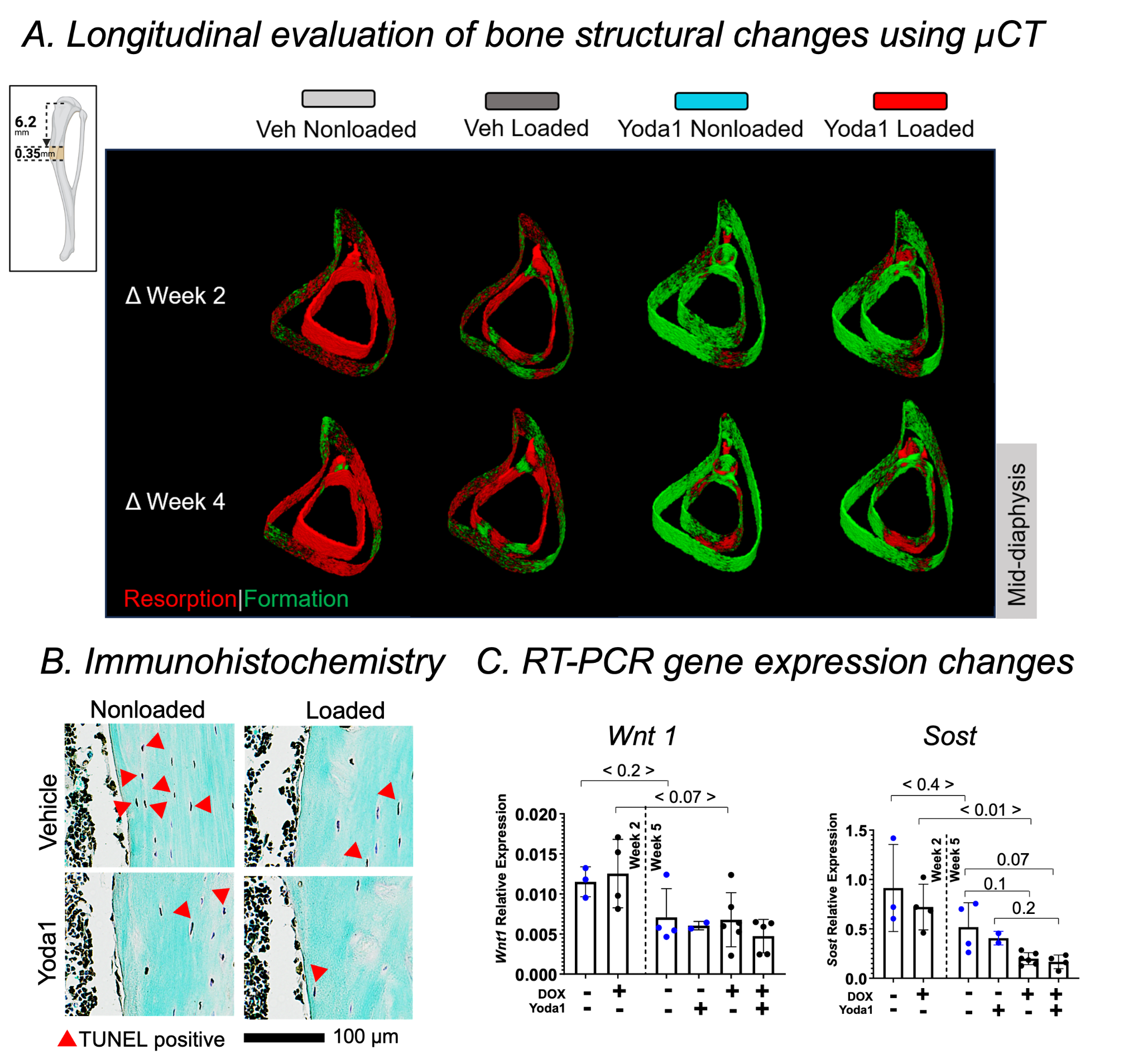 Representative results from the PhD project showing bone remodeling, osteocyte apoptosis, osteoclast activity, and osteoblast response under Yoda1 and mechanical loading conditions.