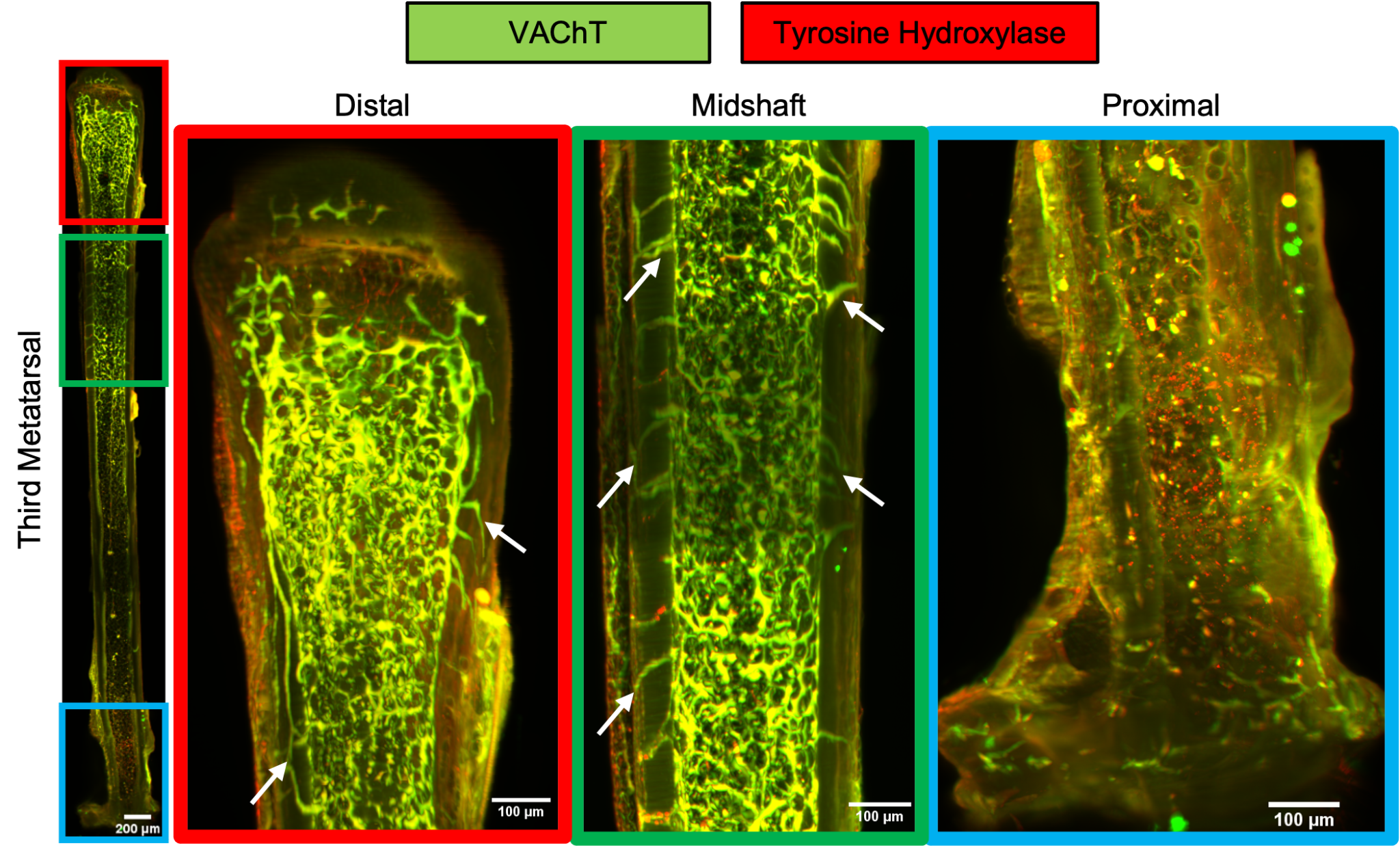 Whole-bone 3D imaging of skeletal innervation showing VAChT and tyrosine hydroxylase labeling across representative bone regions.